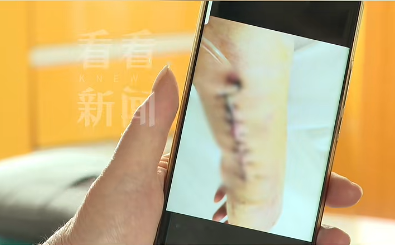 上海阿姨被中欧体育平台保洁员撞成伤残对方：你也有错更气人的是……(图2)
